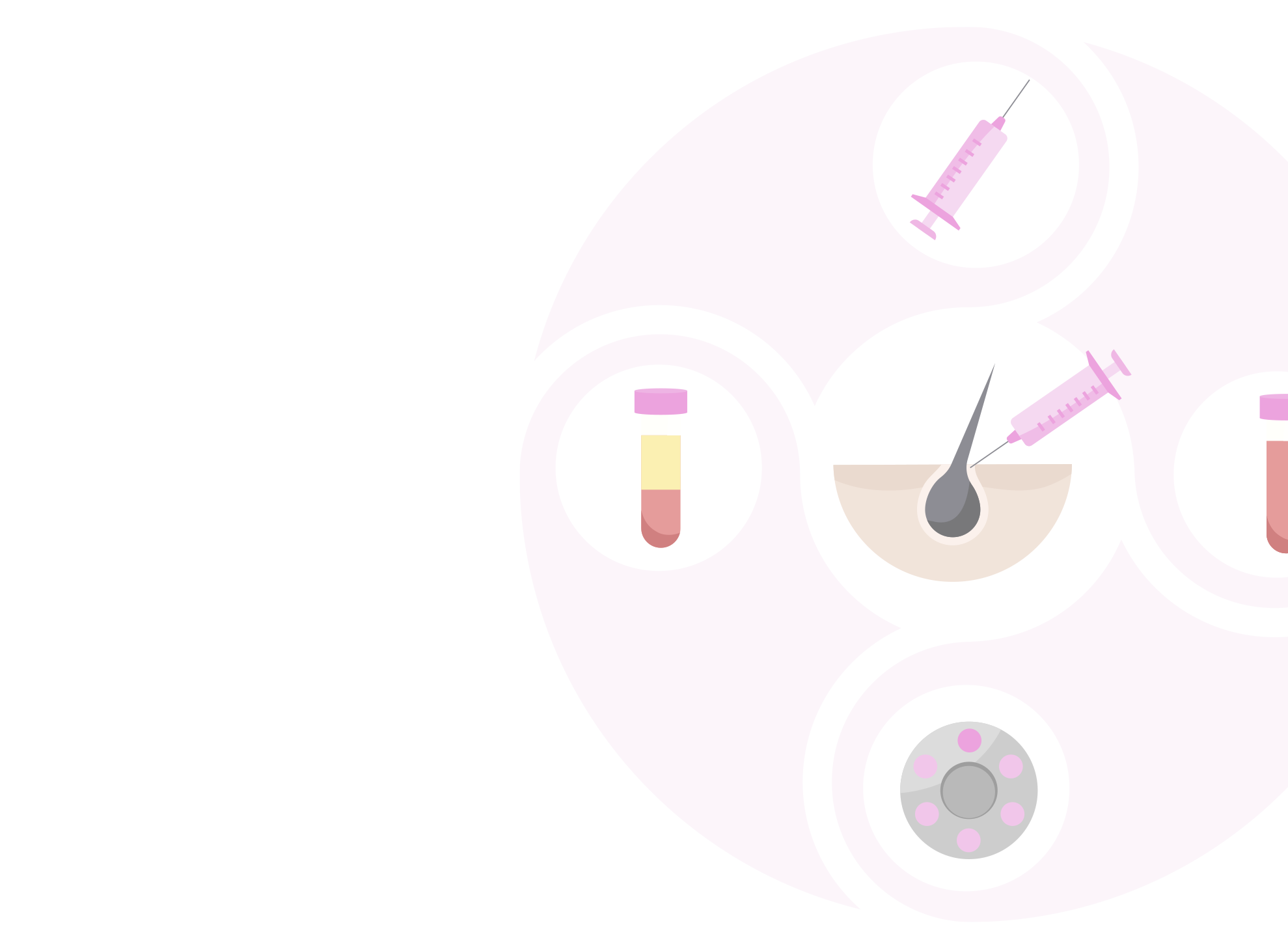 Platelet-Rich Plasma in the Management of Alopecia: A Systematic Review and Meta-Analysis of Clinical Evidence.