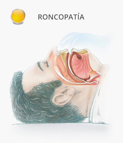 dibujo de hombre con ronquidos