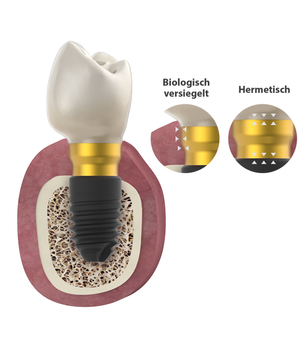 Bioblock